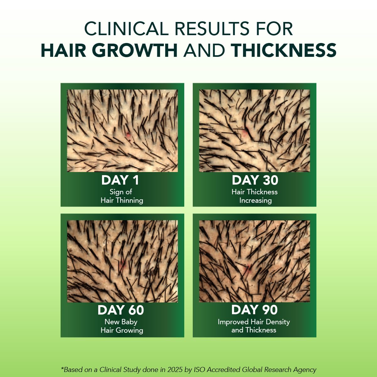 Alps Goodness Rosemary Water Spray for Hair Growth (250ml) | Clinically Proven (In Vivo Tested) to Reduce Hair Fall & Promote Regrowth | 100% Natural Rosemary Extract | Leave-On Scalp & Hair Spray For Men & Women