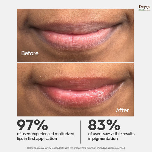 Deyga Beetroot Lip Balm | Tinted Lip Care | For Dry & Chapped Lips | For Pigmented Lips | For Women & Men (Pack of 1, Stick Lip Balm), Red